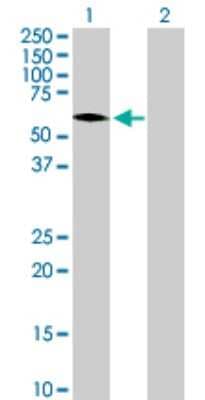 Western Blot: ZNF257 Antibody [H00113835-B01P]
