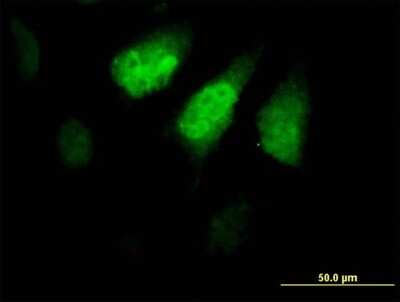 Immunocytochemistry/ Immunofluorescence: ZNF259 Antibody [H00008882-B01P]