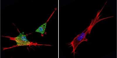 Immunocytochemistry/ Immunofluorescence: ZNF259 Antibody (LG1) - BSA Free [NBP2-22448]