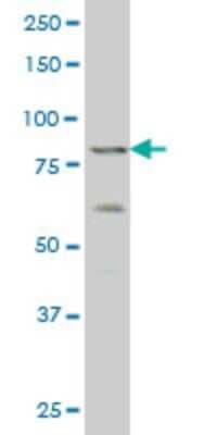 Western Blot: ZNF263 Antibody (1F9) [H00010127-M02]