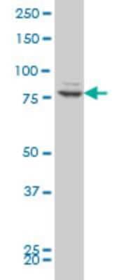 Western Blot: ZNF263 Antibody (2A1) [H00010127-M03]