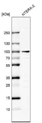 Western Blot: ZNF263 Antibody [NBP1-81868]