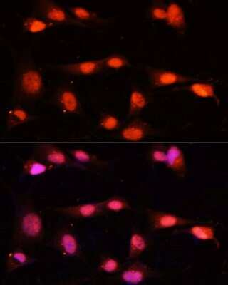 Immunocytochemistry/ Immunofluorescence: ZNF264 Antibody - BSA Free [NBP2-94825]
