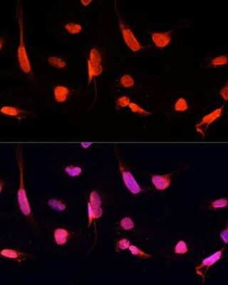 Immunocytochemistry/ Immunofluorescence: ZNF264 Antibody - BSA Free [NBP2-94825]