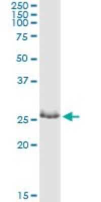 Immunoprecipitation: ZNF266 Antibody (1B9) [H00010781-M05]