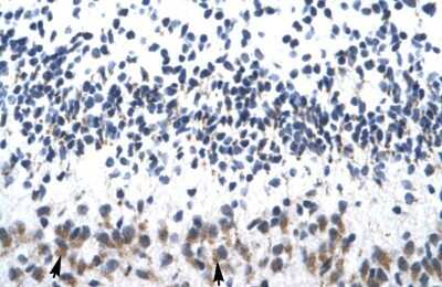 Immunohistochemistry-Paraffin: ZNF266 Antibody [NBP1-80114]