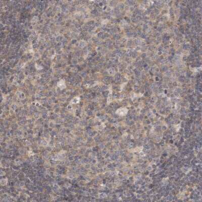Immunohistochemistry-Paraffin: ZNF267 Antibody [NBP1-81633]