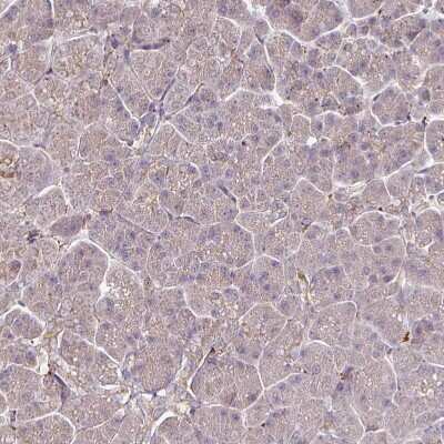 Immunohistochemistry-Paraffin: ZNF268 Antibody [NBP2-13562]