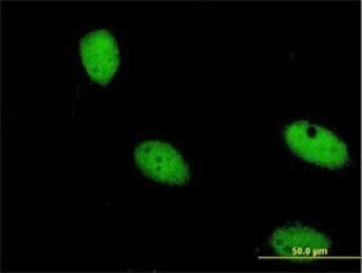 Immunocytochemistry/ Immunofluorescence: ZNF274 Antibody (1D8) [H00010782-M04]
