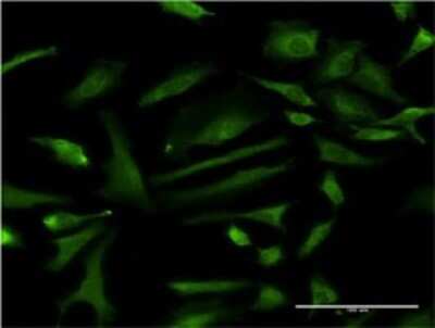 Immunocytochemistry/ Immunofluorescence: ZNF274 Antibody (4C12) [H00010782-M01]