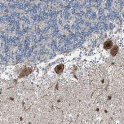 Immunohistochemistry-Paraffin: ZNF276 Antibody [NBP1-82681]