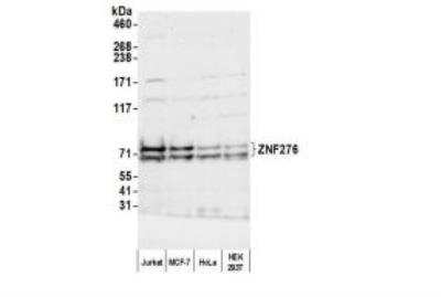 Western Blot: ZNF276 Antibody [NBP1-03342]