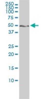 Western Blot: ZNF277 Antibody (1B2) [H00011179-M01]