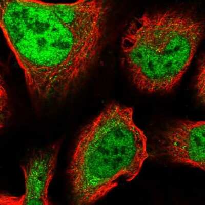 Immunocytochemistry/ Immunofluorescence: ZNF281 Antibody [NBP2-13564]