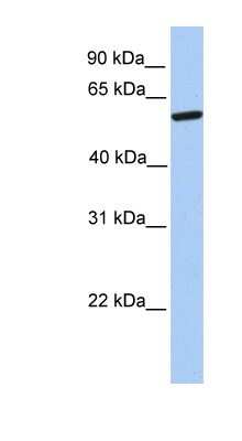 Western Blot: ZNF284 Antibody [NBP1-91368]