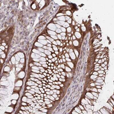 Immunohistochemistry: ZNF285A Antibody [NBP2-33454]