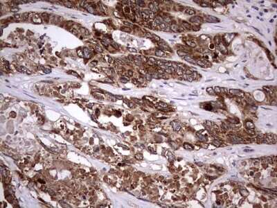 Immunohistochemistry: ZNF286 Antibody (OTI7D2) [NBP2-46432]