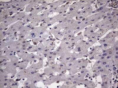 Immunohistochemistry: ZNF286 Antibody (OTI7D2) [NBP2-46432]