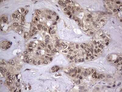 Immunohistochemistry: ZNF286 Antibody (OTI7D2) [NBP2-46432]