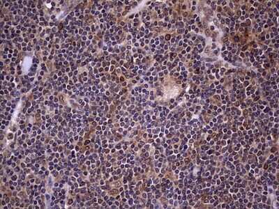 Immunohistochemistry: ZNF286 Antibody (OTI7D2) [NBP2-46432]