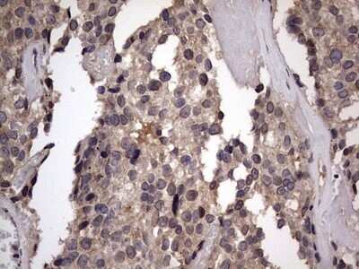 Immunohistochemistry: ZNF286 Antibody (OTI7D2) - Azide and BSA Free [NBP2-74935]