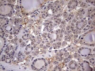 Immunohistochemistry: ZNF286 Antibody (OTI7D2) - Azide and BSA Free [NBP2-74935]