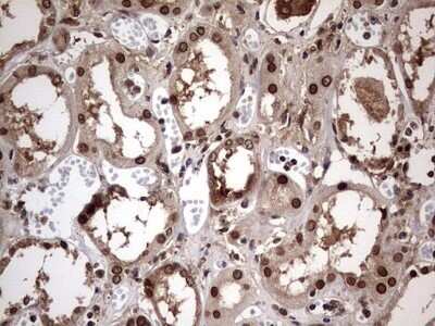 Immunohistochemistry: ZNF286 Antibody (OTI7D2) - Azide and BSA Free [NBP2-74935]
