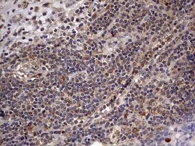 Immunohistochemistry: ZNF286 Antibody (OTI7D2) - Azide and BSA Free [NBP2-74935]