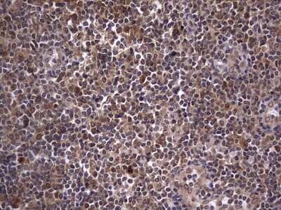 Immunohistochemistry: ZNF286 Antibody (OTI7D2) - Azide and BSA Free [NBP2-74935]