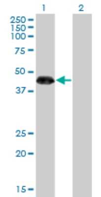 Western Blot: ZNF3 Antibody (1F7) [H00007551-M08]
