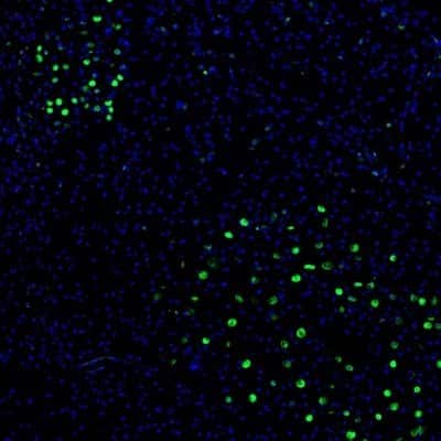 Immunocytochemistry/ Immunofluorescence: ZNF3 Antibody [NBP1-89329]
