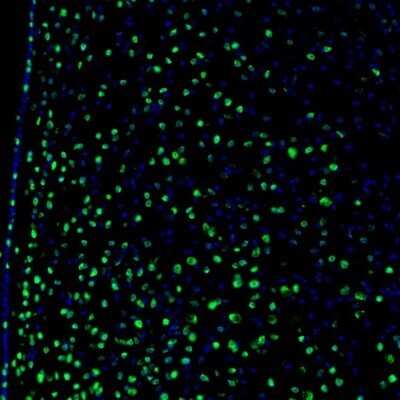 Immunocytochemistry/ Immunofluorescence: ZNF3 Antibody [NBP1-89329]