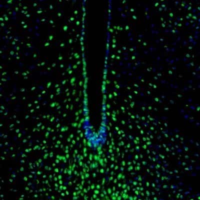 Immunocytochemistry/ Immunofluorescence: ZNF3 Antibody [NBP1-89329]