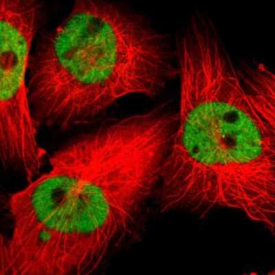 Immunocytochemistry/ Immunofluorescence: ZNF3 Antibody [NBP1-89329]
