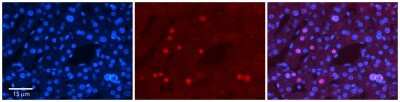 Immunohistochemistry-Paraffin: ZNF3 Antibody [NBP2-86471]