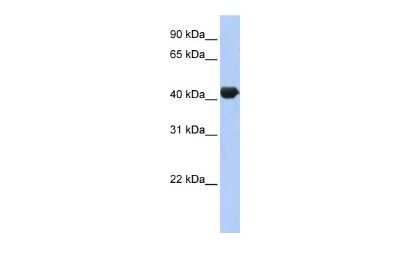 Western Blot: ZNF3 Antibody [NBP2-86471]