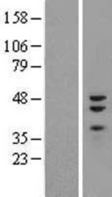 Western Blot: ZNF3 Overexpression Lysate [NBL1-18112]