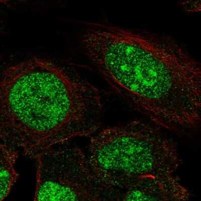 Immunocytochemistry/ Immunofluorescence: ZNF300 Antibody [NBP2-58118]
