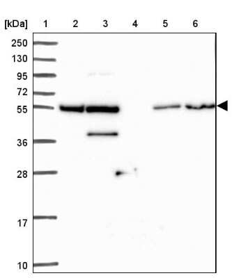 Western Blot: ZNF300 Antibody [NBP2-13566]