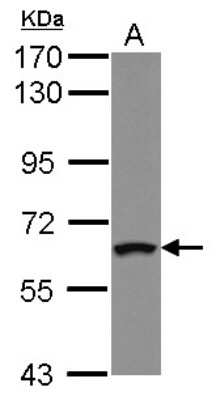 Western Blot: ZNF300 Antibody [NBP2-20987]