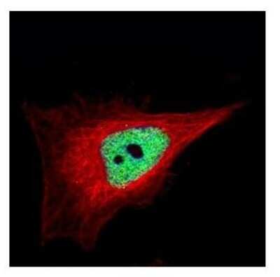Immunocytochemistry/ Immunofluorescence: ZNF302 Antibody [NBP2-15169]