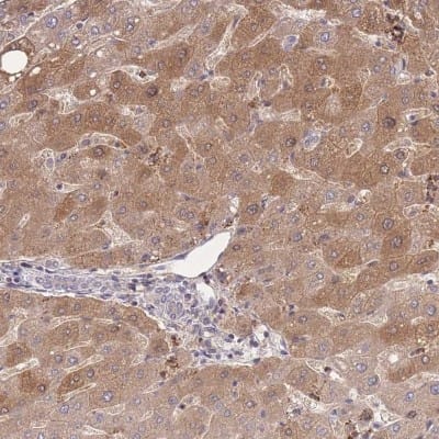 Immunohistochemistry-Paraffin: ZNF304 Antibody [NBP2-31901]