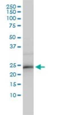 Western Blot: ZNF313 Antibody (4G3-1A10) [H00055905-M01]
