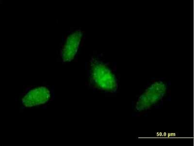 Immunocytochemistry/ Immunofluorescence: ZNF313 Antibody [H00055905-B01P]