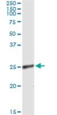 Immunoprecipitation: ZNF313 Antibody (S2) [H00055905-M03]