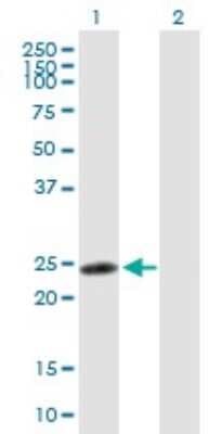 Western Blot: ZNF313 Antibody [H00055905-B01P]