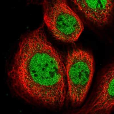 Immunocytochemistry/ Immunofluorescence: ZNF317 Antibody [NBP1-86220]