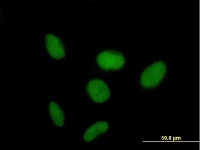 Immunocytochemistry/ Immunofluorescence: ZNF319 Antibody [H00057567-B01P]