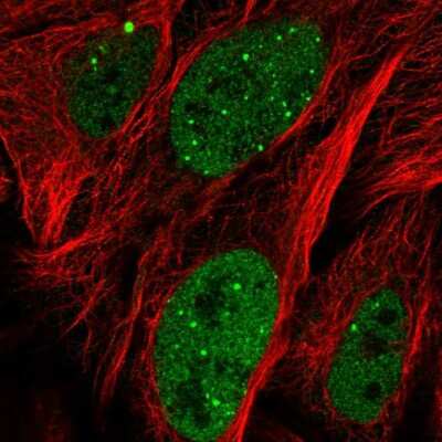 Immunocytochemistry/ Immunofluorescence: ZNF32 Antibody [NBP2-55012]