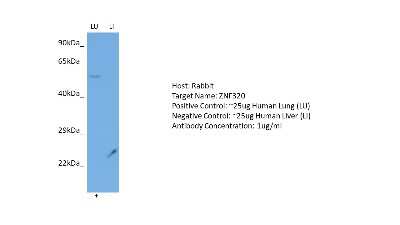 Western Blot: ZNF320 Antibody [NBP2-86473]
